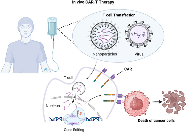 CAR T-Cell Therapy